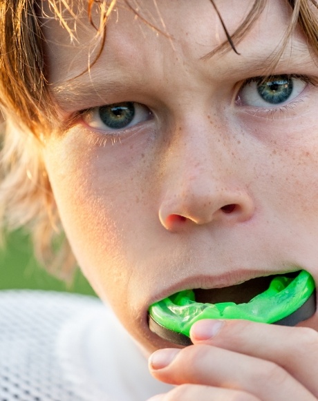 Teen placing an athletic mouthguard