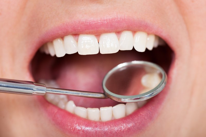 Mouth inspected with dental mirror